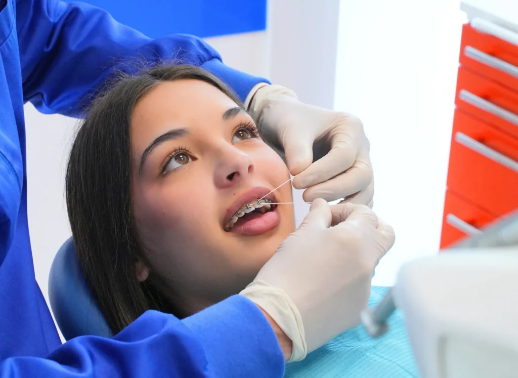 Denti storti nei bambini