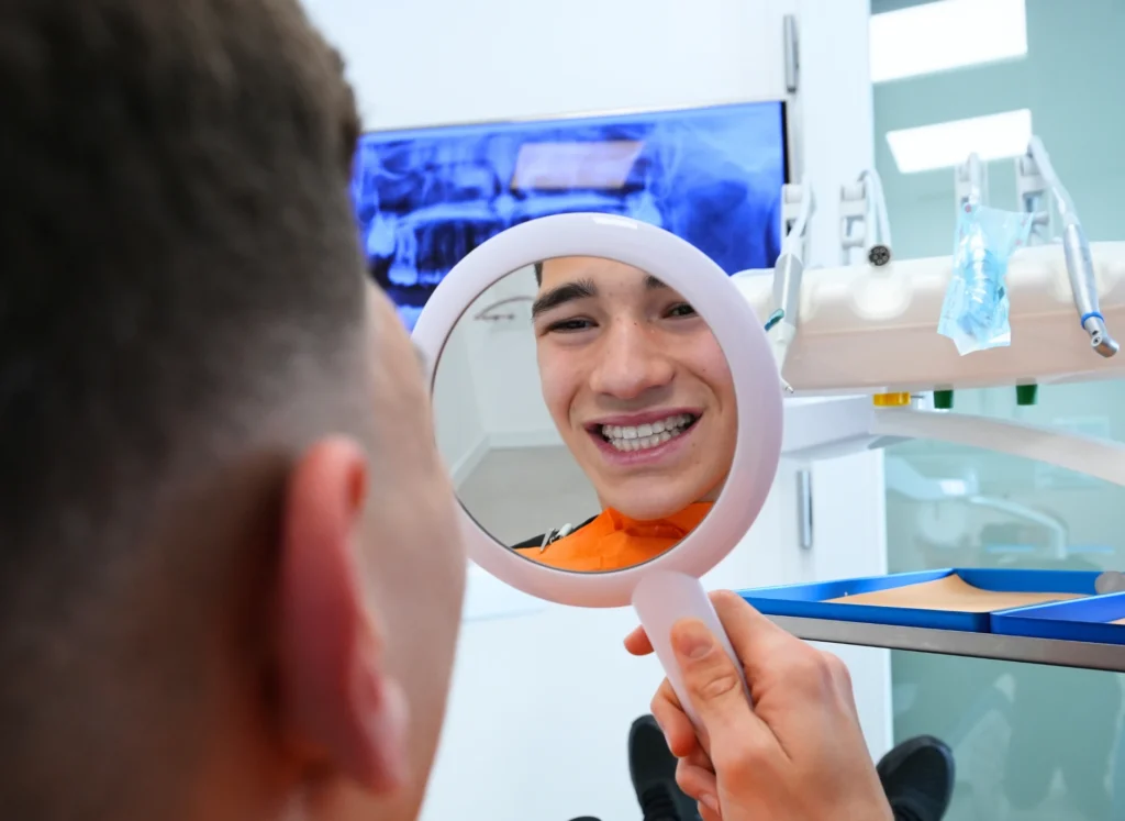 Apparecchio trasparente: come funziona e per chi è indicato 2 sorrisi prima e dopo a Cagliari - Apparecchio trasparente